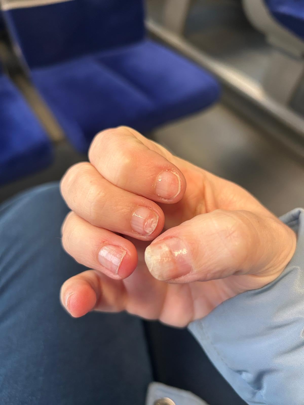 Sauvé mes ongles